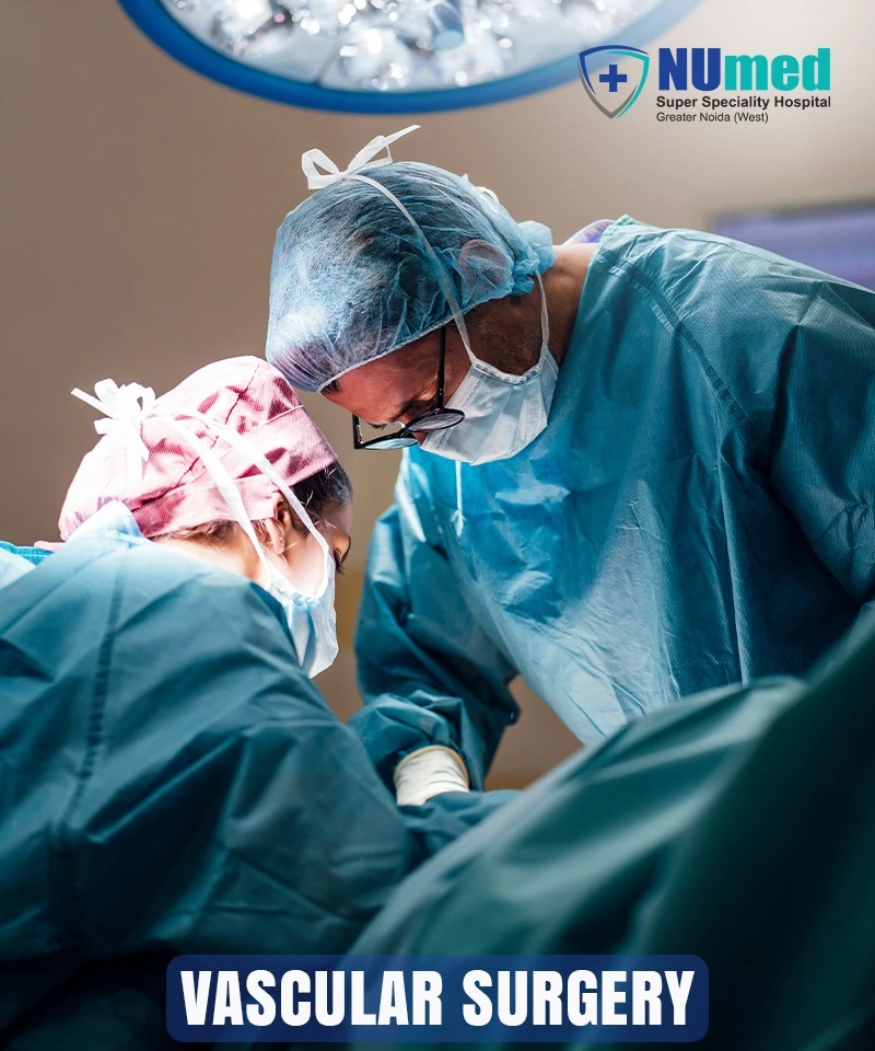 Best Vascular Surgery Hospital in Greater Noida