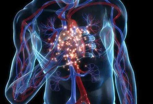 Heart Disease: Signs, Causes & Treatment