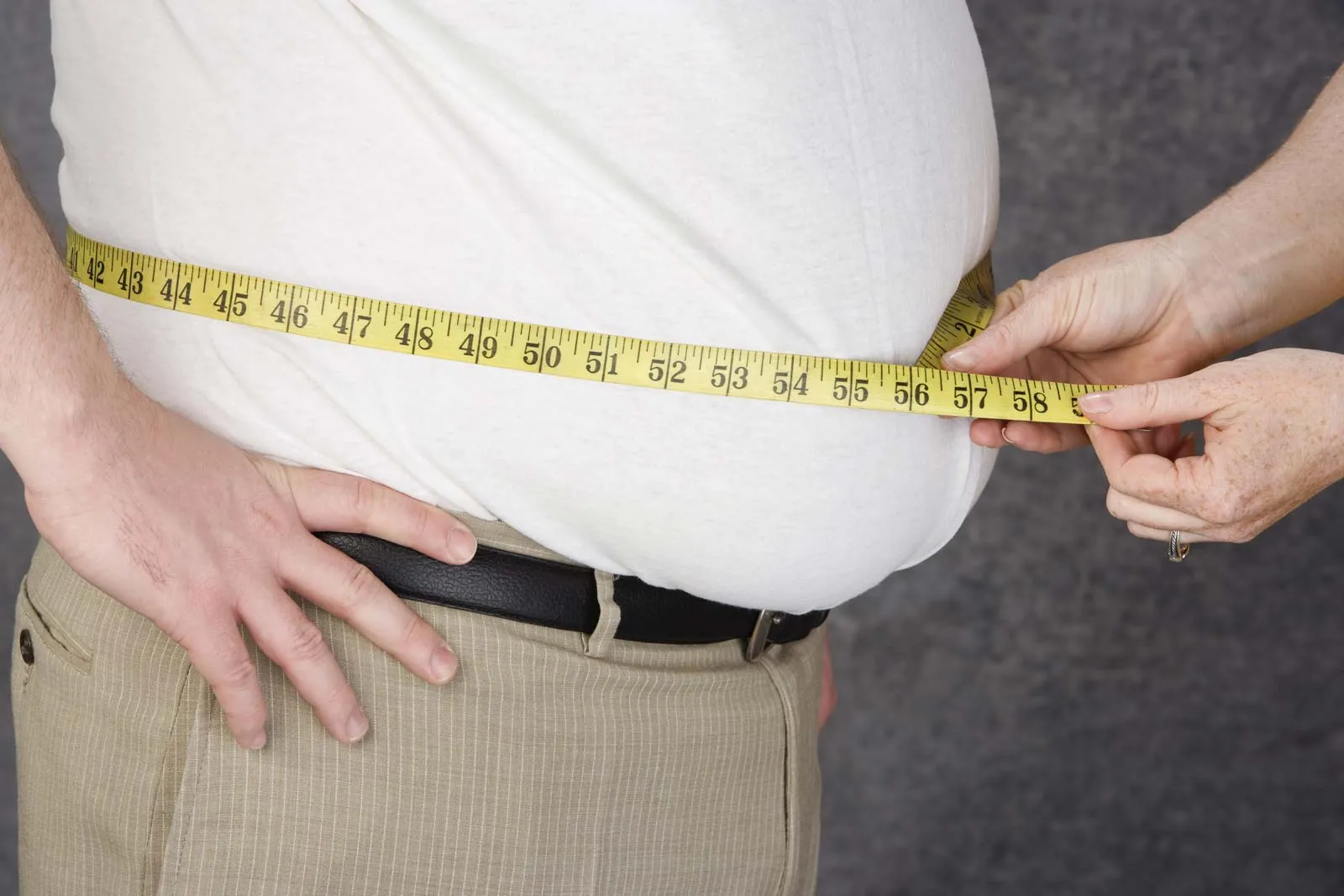 Obesity – Causes, Symptoms & Treatment Options