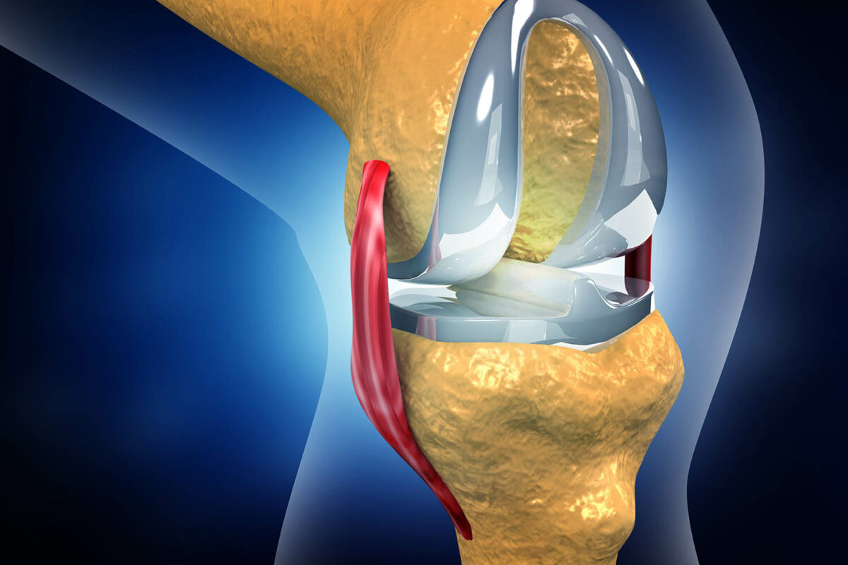 Total Knee Replacement