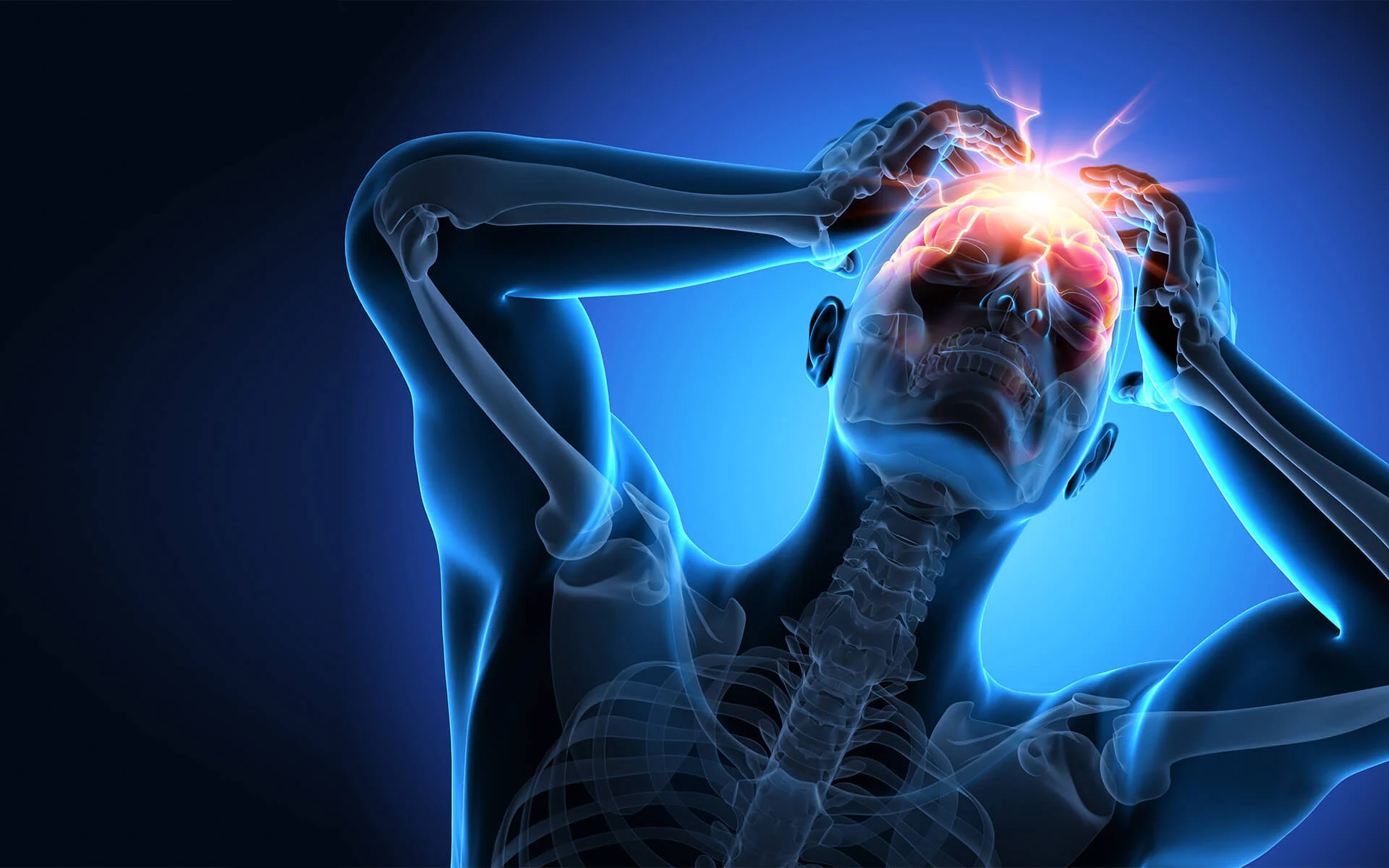 Severe Headache: Signs, Causes & Treatment