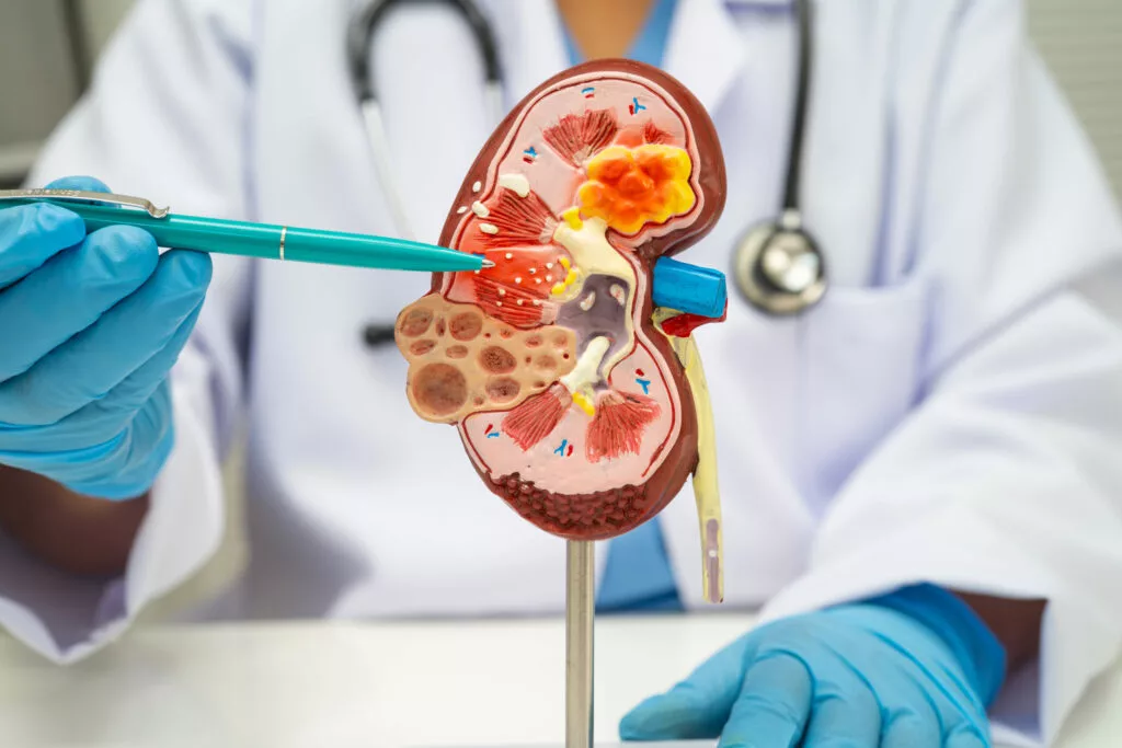 Kidney diseases