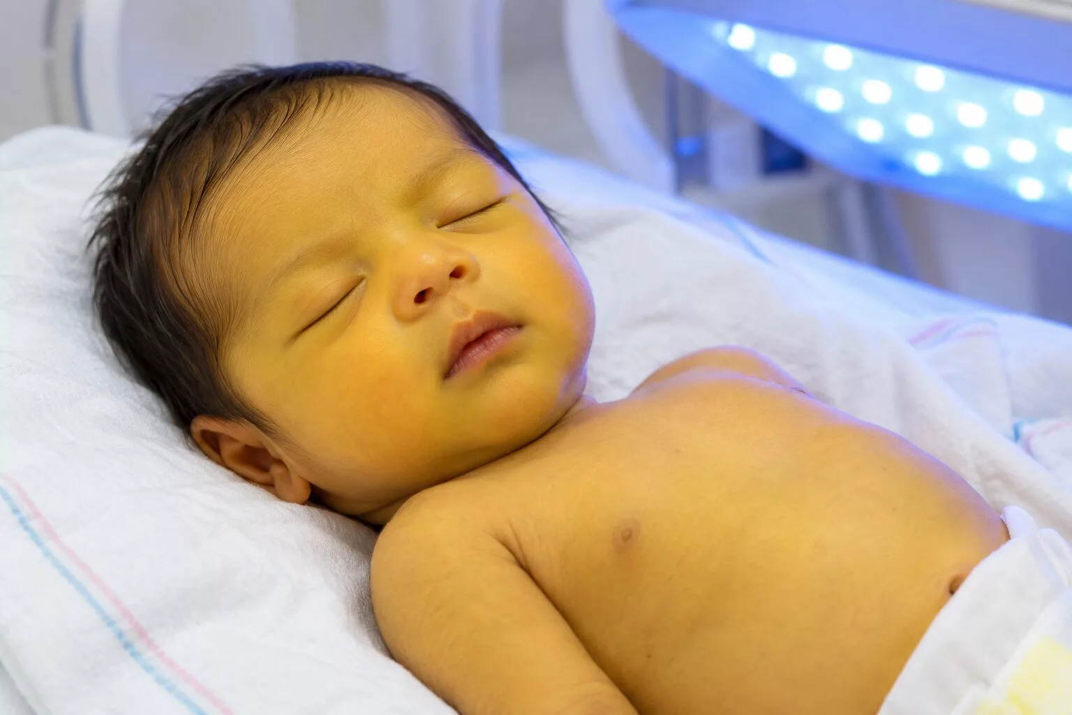 signs of recovery from jaundice in newborns​